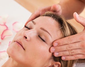 Gesichtsakupunktur Lausanne (65 Min.)